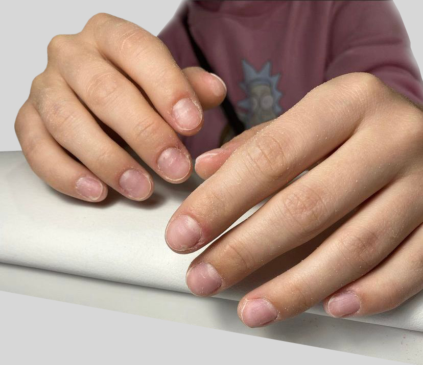 Картинка 5 результат до процедуры Маникюр